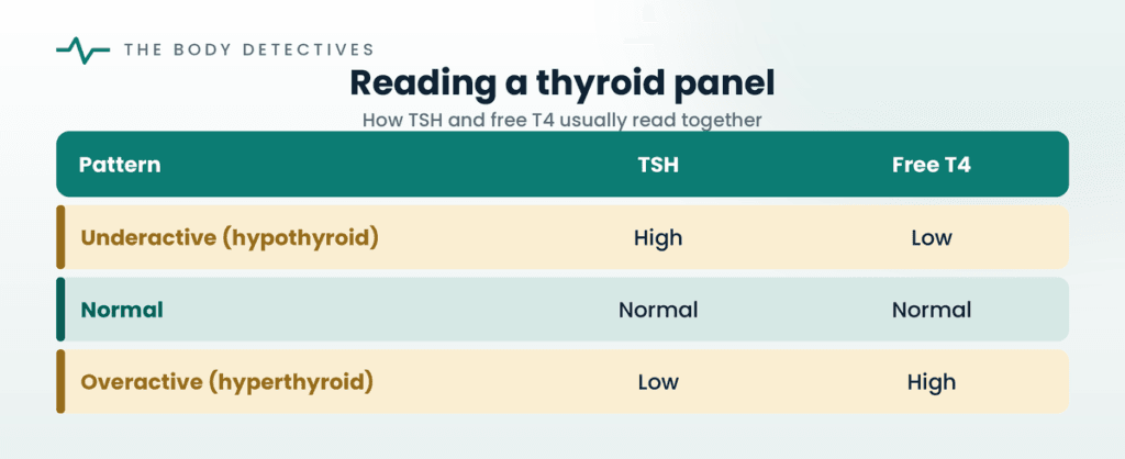 thyroid panel TSH and T4 chart