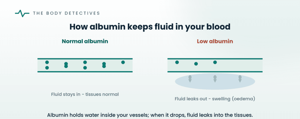 how albumin keeps fluid in blood vessels diagram