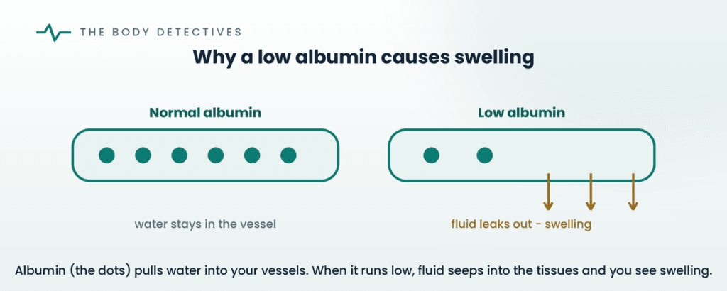 albumin fluid balance swelling diagram