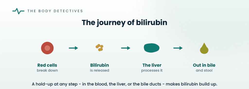 where bilirubin comes from diagram