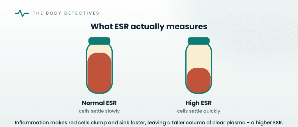 ESR red blood cells settling diagram