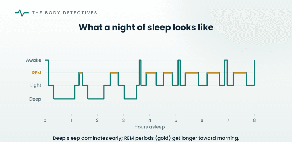 sleep stages hypnogram diagram